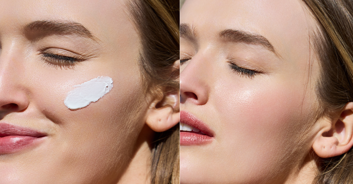 Why You Need SPF Every Day and What the Sun Actually Does to Your Skin